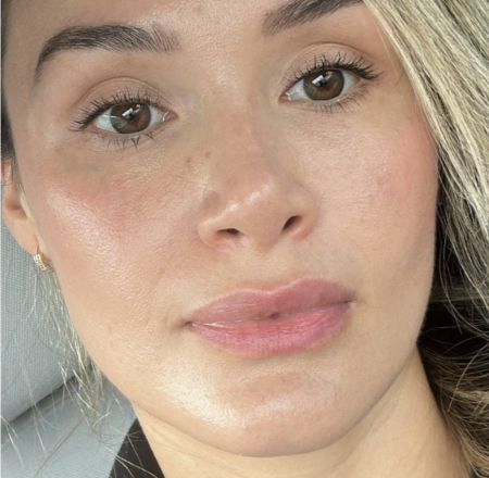 After Brightening Facial